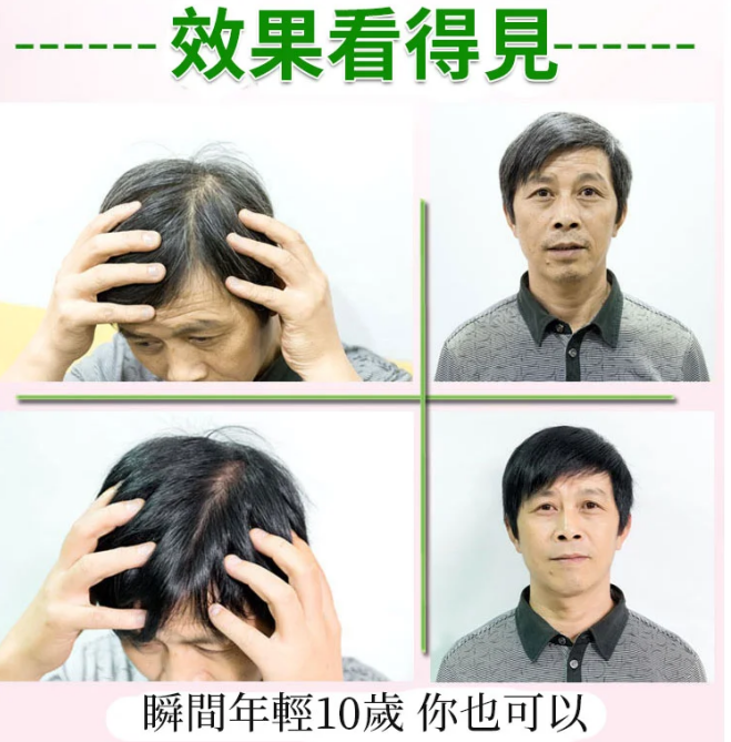 植物染髮,洗一次黑一年,完全遮蓋白頭髮,只黑頭髮,不黑頭皮,安全無毒不過敏。 植物染髮,洗一次黑一年,完全遮蓋白頭髮,只黑頭髮,不黑頭皮,安全無毒不過敏。