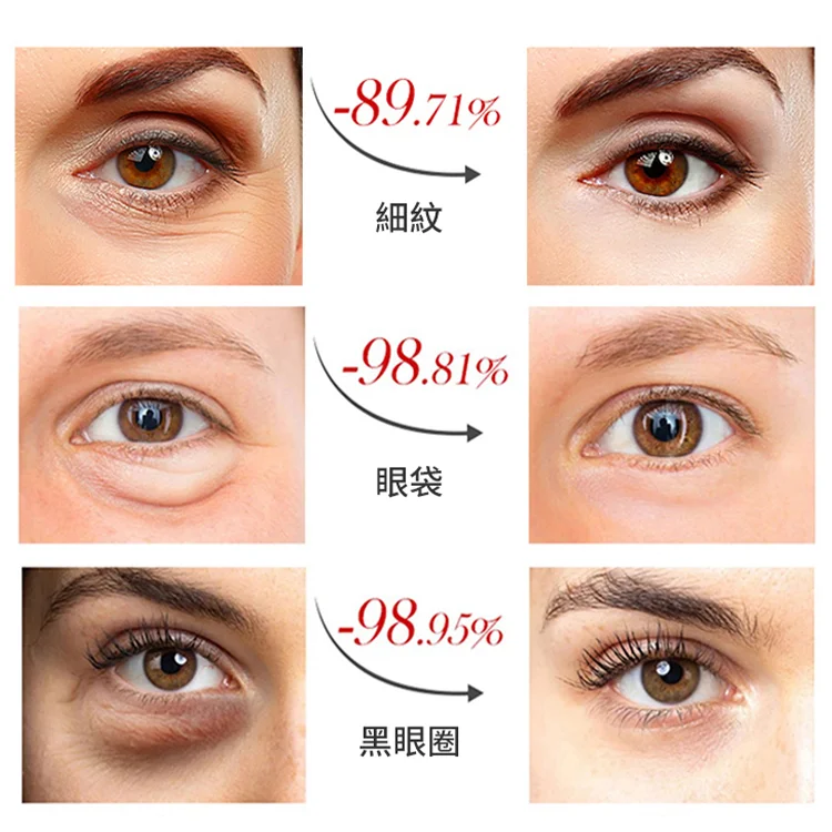 滬美24K黃金瑩潤眼膜，美容院同步使用 輕鬆解決各種眼部問題