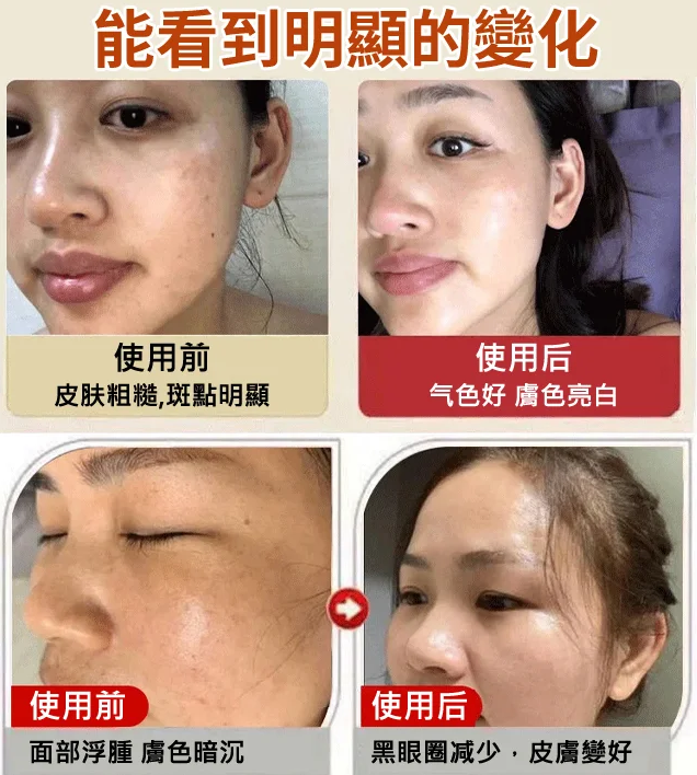 膜西野蔬菜深層補水清潔霜,清除黑頭,趕走痘痘,可以養膚的清潔霜,深層清潔,肌膚水嫩嘭彈 膜西野蔬菜深層補水清潔霜,清除黑頭,趕走痘痘,可以養膚的清潔霜,深層清潔,肌膚水嫩嘭彈