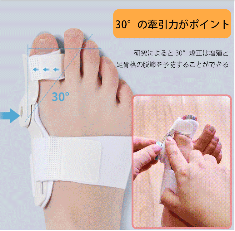 日本骨科醫生推薦】Tenicore獨家3D旋調整骨拇指外翻矯正器, 科學矯正不傷骨 日本骨科醫生推薦】Tenicore獨家3D旋調整骨拇指外翻矯正器, 科學矯正不傷骨